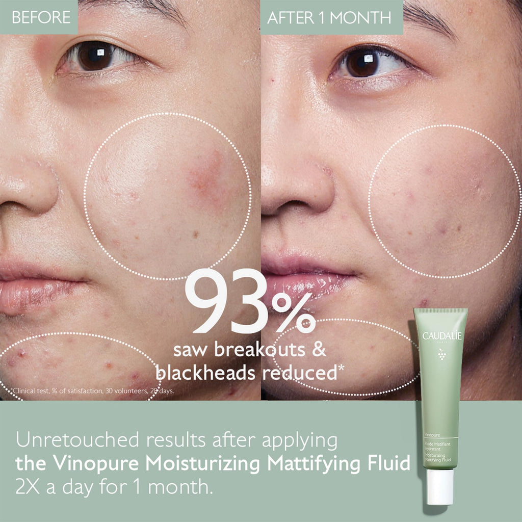 Oil Control Moisturizer 40 mL W8879
